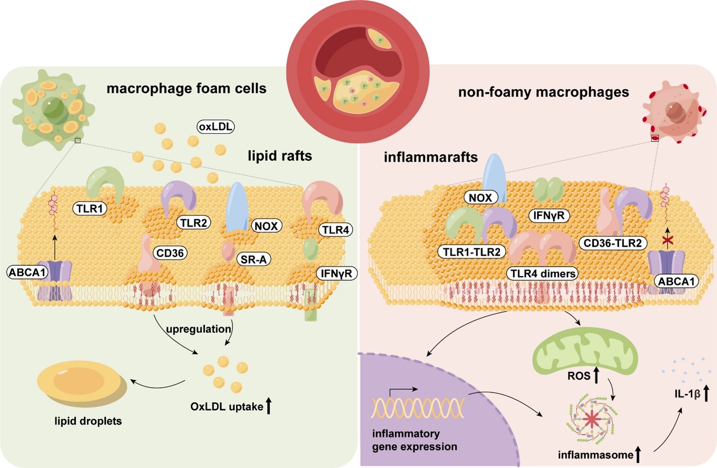 ATHEROSCLEROSIS